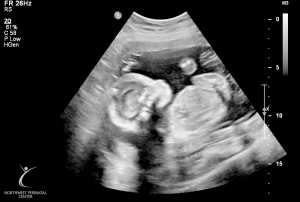 ultrasound 2014-12-10 04.jpg